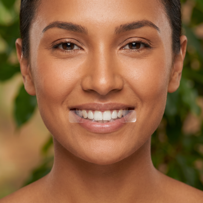 Nova Whitening Strips